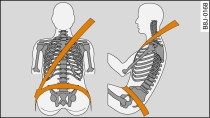 Colocación de la banda del hombro y de la banda abdominal
